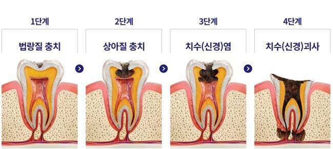 이미지명