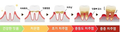 이미지명