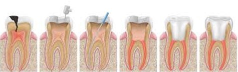 이미지명