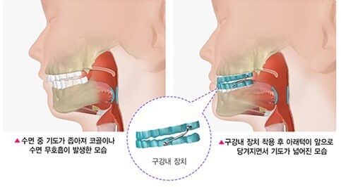 이미지명