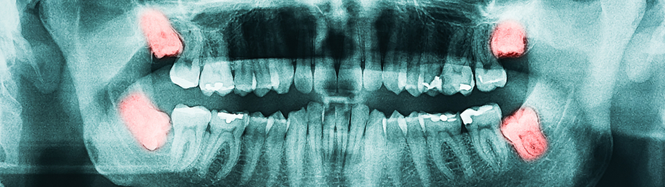 FOR ESTHETIC DENTAL CLINIC