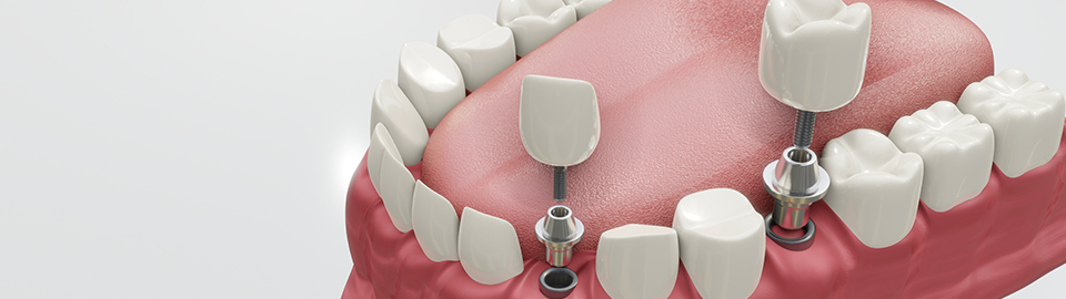 FOR ESTHETIC DENTAL CLINIC