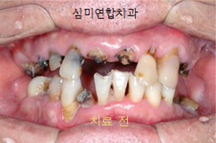 이미지샘플