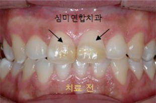 이미지샘플