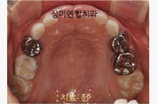 이미지샘플