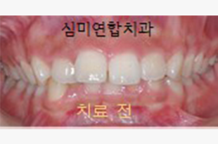 이미지샘플
